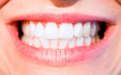 Beneficios de una ortodoncia adecuada
