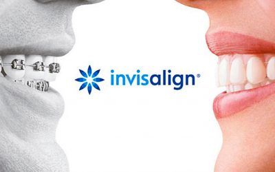 Invisalign, ahora en Clínica Dental Pradillo